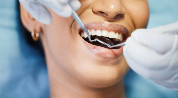 Best Emergency Dental Extractions in Hoover, AL